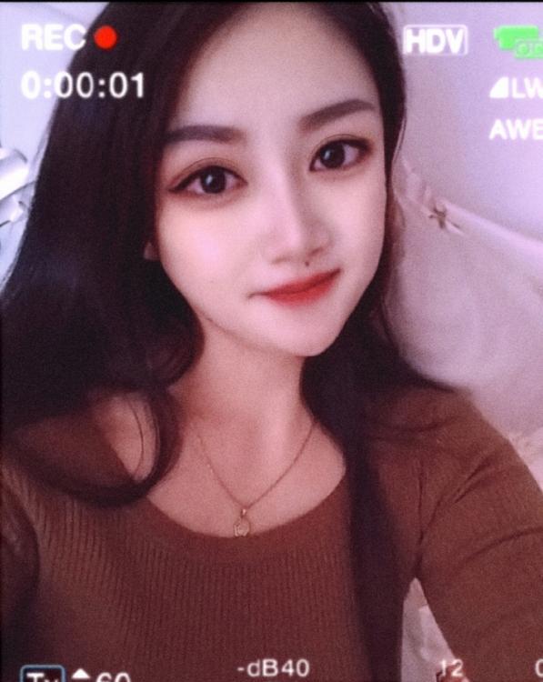 苏州园区莲花小项